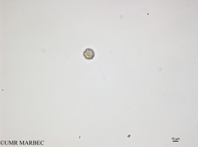 phyto/Bizerte/bizerte_bay/RISCO April 2014/Coccolithophoride 8 (150126_001_ovl -1)(copy)_thumb.jpg